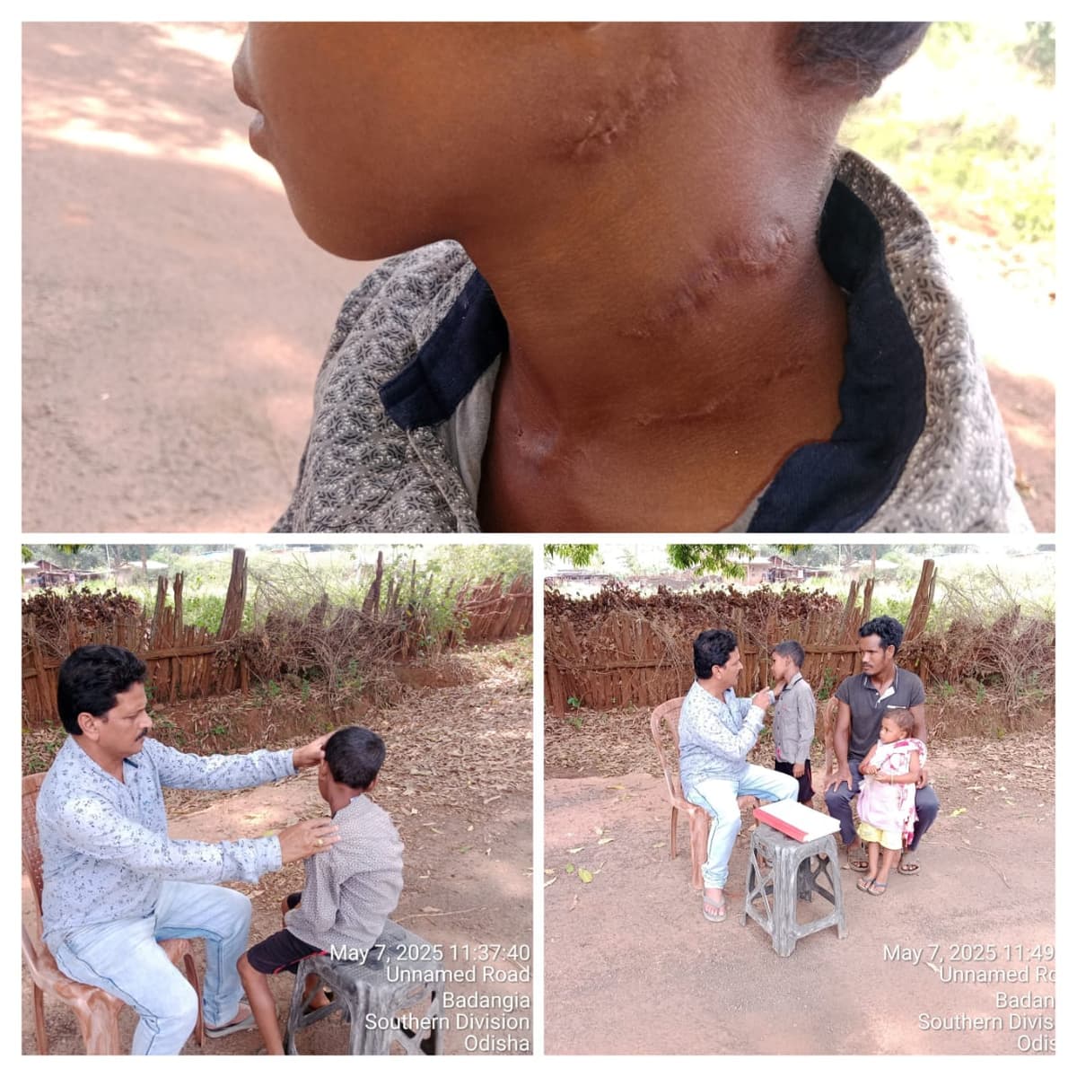 Malaria Control Programme